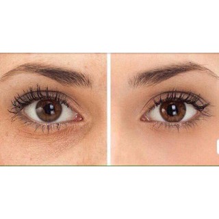 Kem Kumargic Eye 20g của Nhật Hỗ Trợ Cải Thiện Thâm Quầng Mắt | BigBuy360 - bigbuy360.vn
