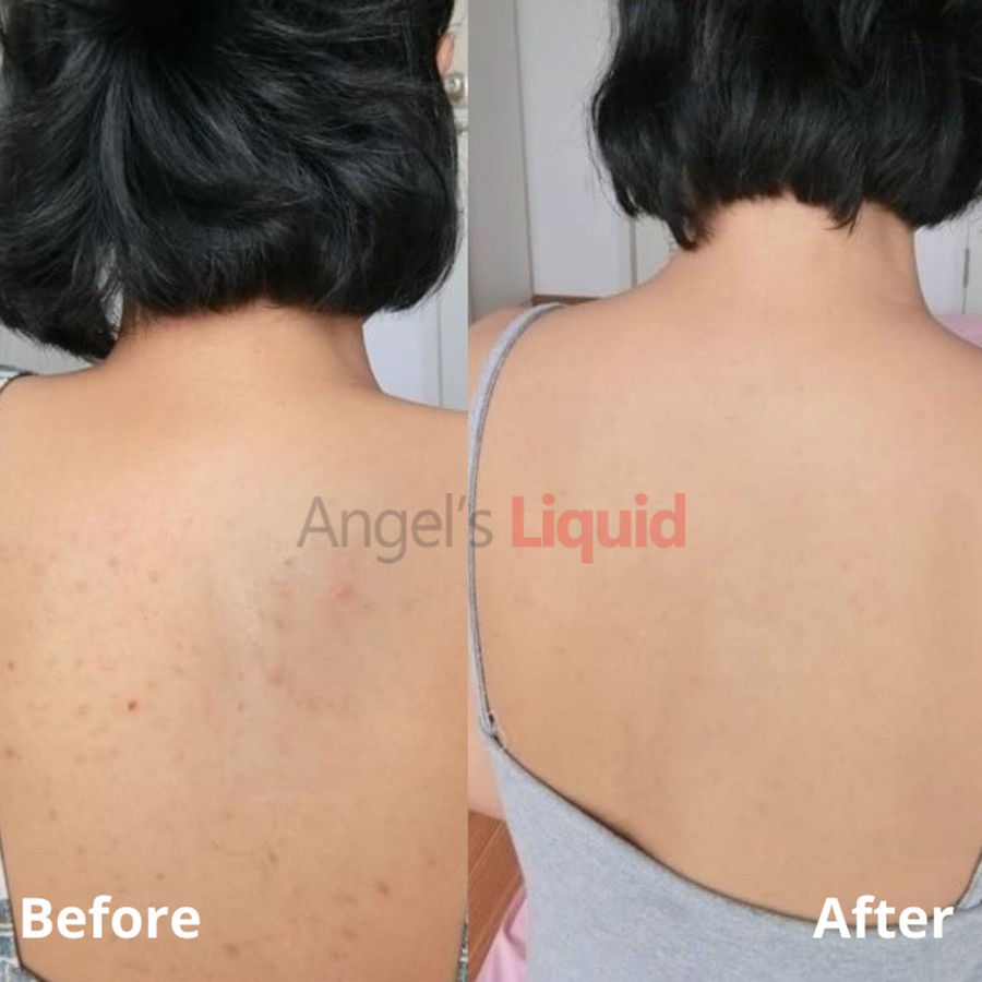 Xịt giảm mụn lưng, dưỡng trắng cơ thể Angel's Liquid Glutathione Centella Calming Body Mist