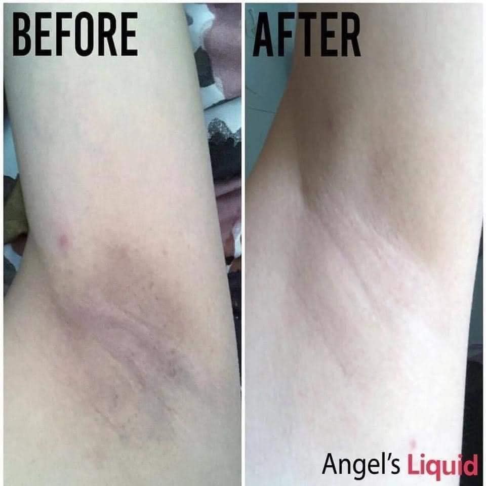 Lăn nách mờ thâm, dưỡng trắng da Angel Liquid Glutathione plus Niacinamide Fresh Deodorant 60ml | BigBuy360 - bigbuy360.vn