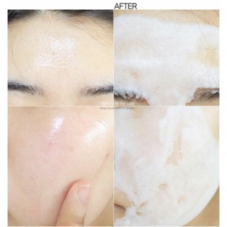 Combo 10 Mặt Nạ Thải Độc Su:m 37 Bright Award Bubble-De Mask
