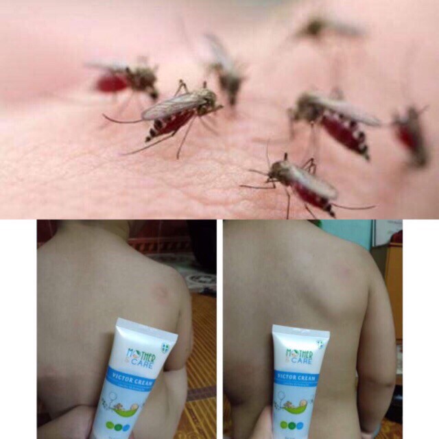 Kem trị muỗi đốt, côn trùng cắn victor cream mothercare