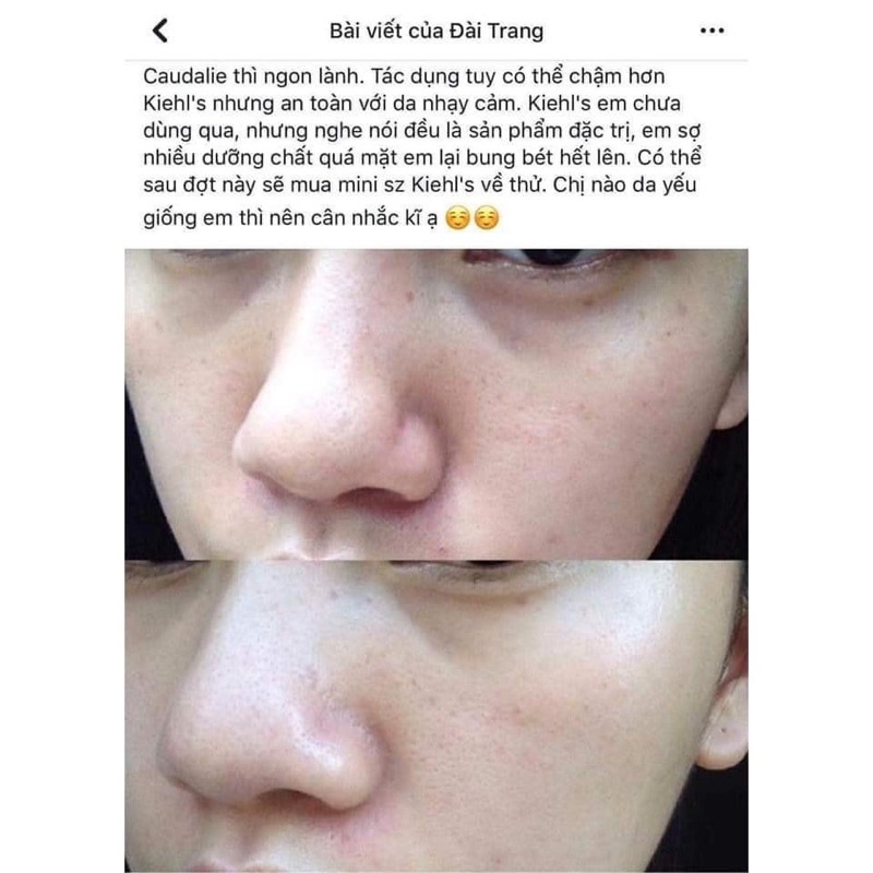 𝐒𝐞𝐫𝐮𝐦 𝐂𝐚𝐮𝐝𝐚𝐥𝐢𝐞 giảm nám dưỡng ẩm trắng da