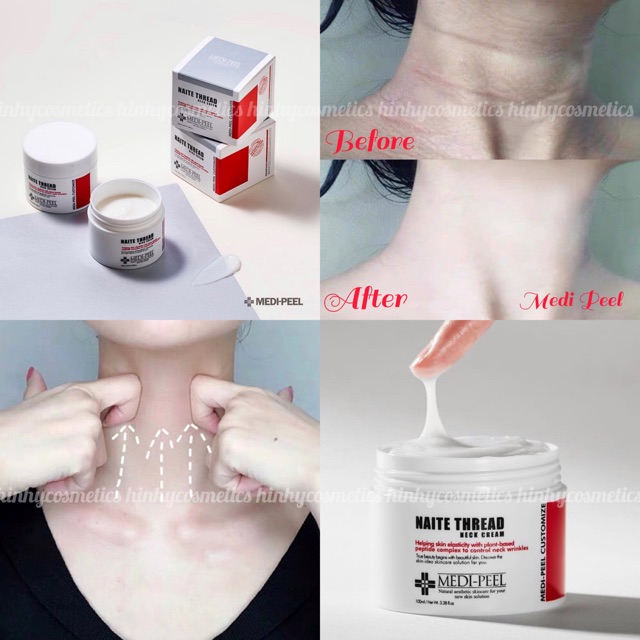 Kem Dưỡng Cổ Naite Thread Neck Medi Peel