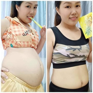 [CHÍNH HÃNG] Thạch dứa giảm cân Hydro Pinapple Burn - Matxi Corp