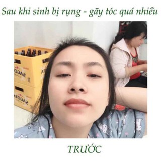 [TRỊ RỤNG TÓC 100%] Tinh Dầu Bưởi Vi Jully KÍCH THÍCH MỌC TÓC - Trị Rụng Tóc