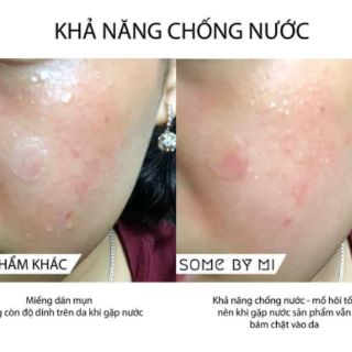 MIẾNG DÁN MỤN SOME BY MI CLEAR SPOT PATCH