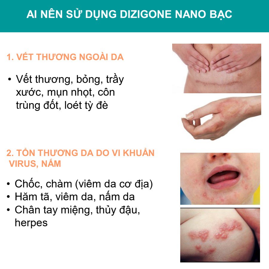 Kem Dizigone nano bạc - Kháng khuẩn, lành vết thương, tái tạo da, ngăn ngừa sẹo