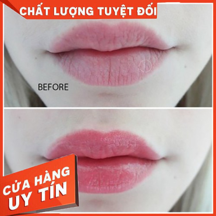 Dưỡng môi VASELINE 7g