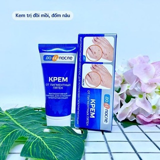 Kem loại bỏ đồi mồi, đốm nâu và dưỡng trắng da tay kpem 50ml nga