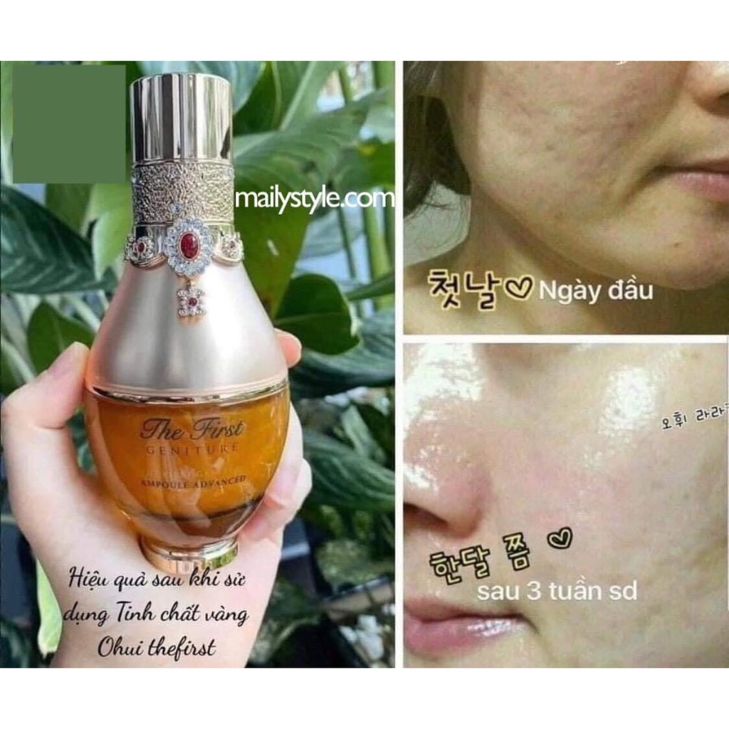 Tinh chất vàng OHUI THE FIRST tái tạo, phục hồi da | BigBuy360 - bigbuy360.vn
