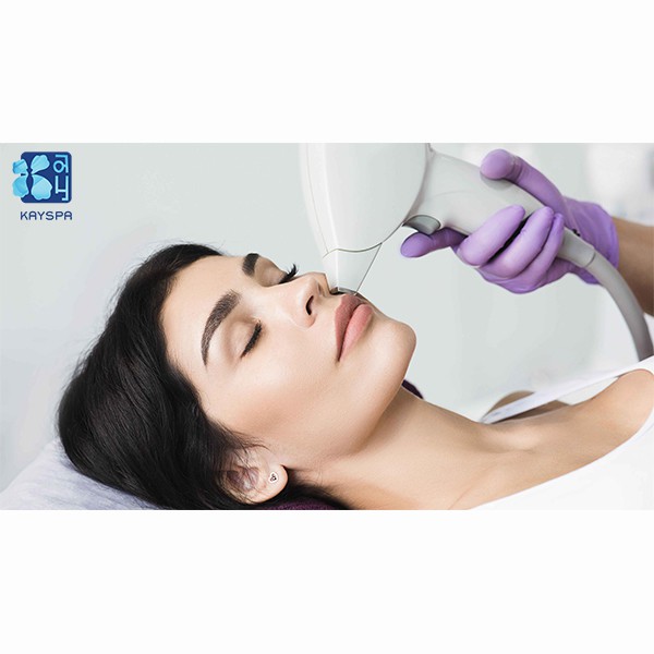 [E-Voucher] Triệt Lông Vùng Ria Mép Công Nghệ Ánh Sáng Sinh Học SHR Tại Kay Spa