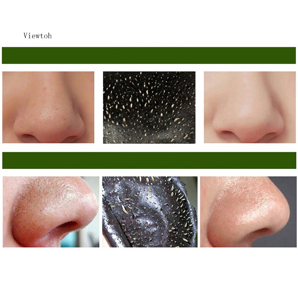 Miếng dán lột mụn đầu đen thu nhỏ lỗ chân lông chiết xuất than hoạt tính | BigBuy360 - bigbuy360.vn