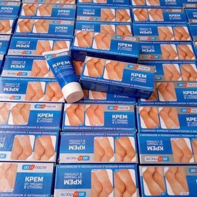 Kem trị nứt gót chân Nga