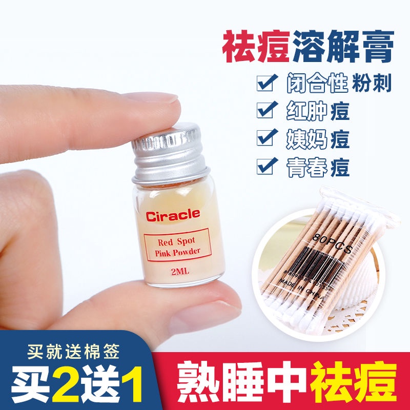 Kem hỗ trợ giảm mụn trứng cá 21 vùng da khôi phục phục hồi làn da hiệu quả qiaoshusheng.11.3 | BigBuy360 - bigbuy360.vn