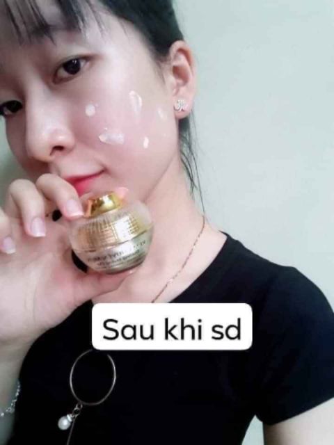 Kem face mụn huỳnh đỗ