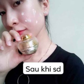 Kem face mụn huỳnh đỗ