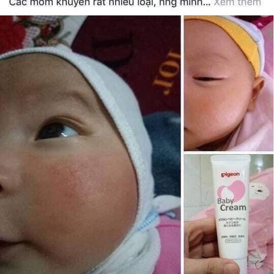 Kem nẻ PIGEON BABY CREAM