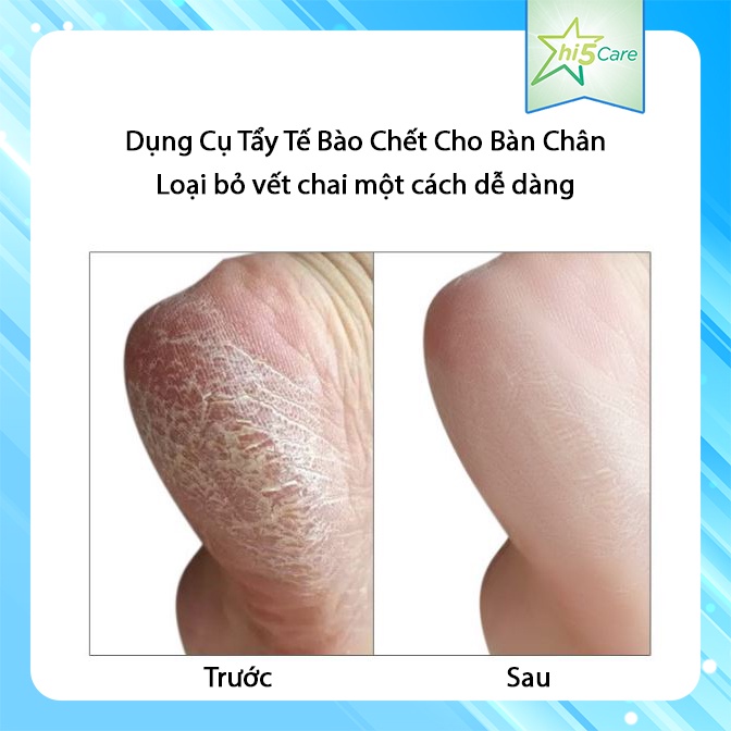 Dụng Cụ Tẩy Tế Bào Chết Cho Bàn Chân  #MG3