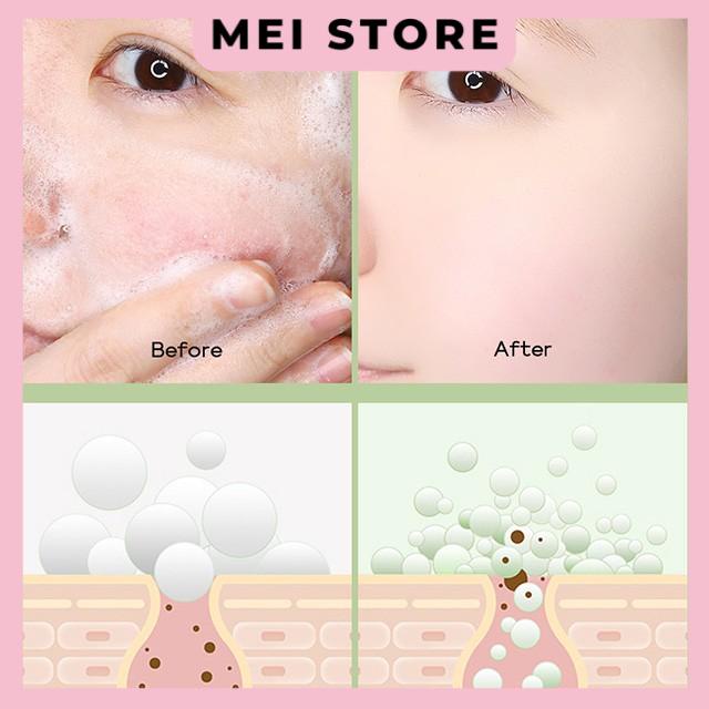 Sữa Rửa Mặt Trà Xanh Fenyi Green Tea Mild Cleanser Ngăn Ngừa Mụn Kiểm Soát Dầu 50g