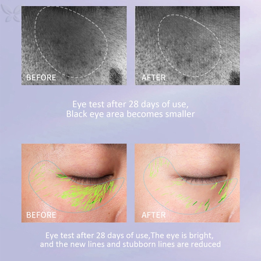 Kem Dưỡng Da Mắt Retinol JMMZ HIH Retinol Làm Săn Chắc Xóa Mờ Quầng Thâm / Bọng Mắt Chống Lão Hóa