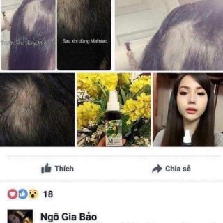 TINH DẦU MỌC TÓC MAHAAD