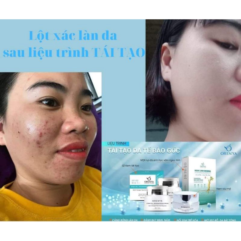 Kem Tái Tạo Tế Bào Gốc – Stem Cell Regenerating - ORENYA