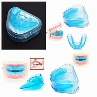 Dụng cụ niềng răng tại nhà