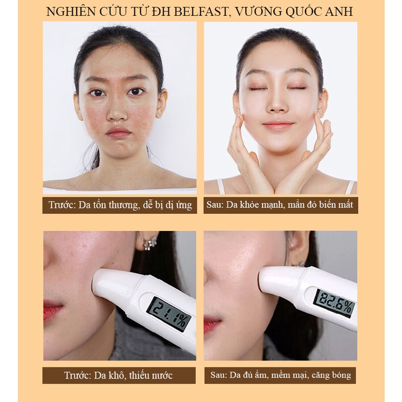 Mặt nạ Sữa lạc đà Hyaluronic Protein dưỡng ẩm sáng da giảm thâm Demyself, mặt nạ nội địa Trung cao cấp