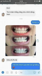 Trắng Răng Than Hoạt Tính❤️