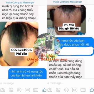 Dầu Gội Bồ Kết Thảo Dược cô đặc
