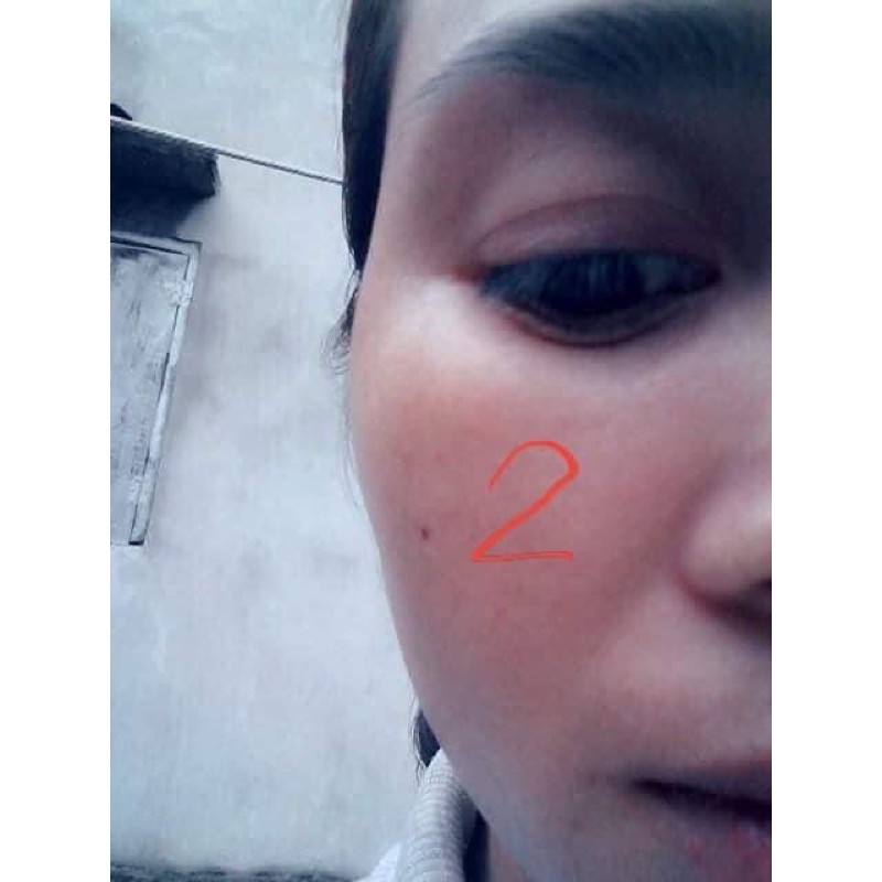 Chấm tàn nhang , nám ,mụn ruồi handmade | BigBuy360 - bigbuy360.vn