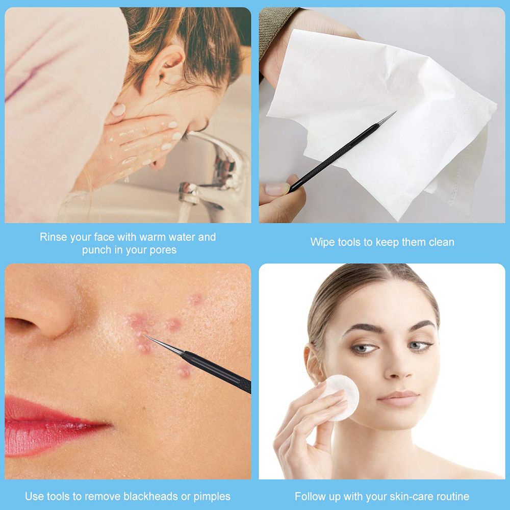 [Hàng mới về] Set dụng cụ loại bỏ mụn đầu đen hai đầu bằng thép không gỉ chăm sóc da có hộp đựng dành cho nữ