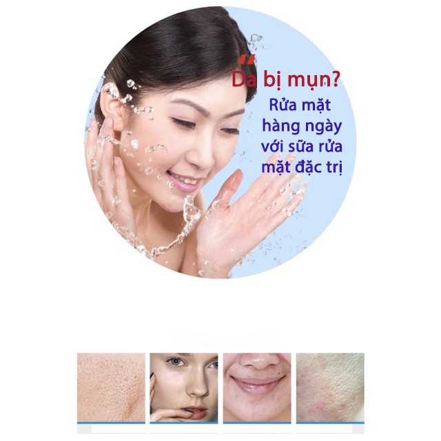 Sữa Rửa Mặt dành cho da Mụn Bioaqua Pure Skin Anti Acne Cleanser - RM09