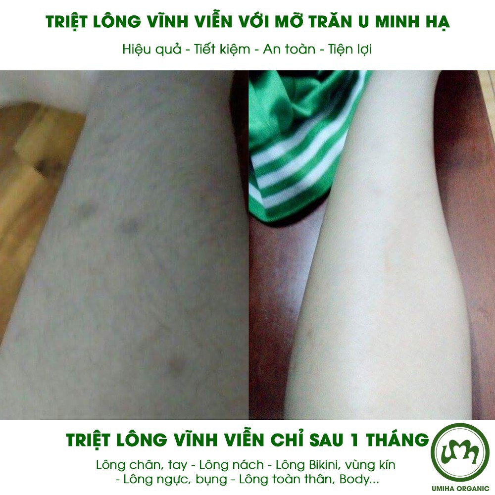 ♀❉Mỡ trăn triệt lông vĩnh viễn U Minh Hạ (10/30ml) - Bikini, Vùng kín, Chân, Tay, Nách, Body hiệu quả