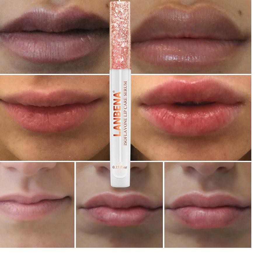 (Hàng Mới Về) Serum Dưỡng Môi Lanbena 88.id Giúp Tăng Cường Độ Đàn Hồi | BigBuy360 - bigbuy360.vn