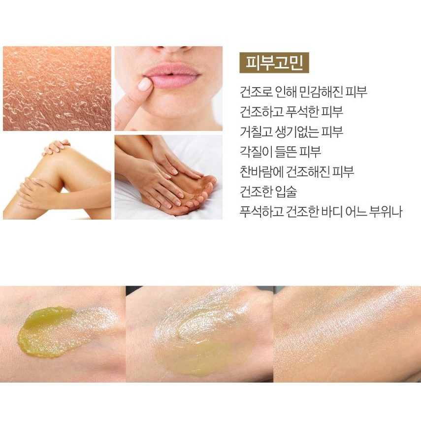 Kem dưỡng ẩm và làm dịu da Kim Jeong Moon Aloe Cure intensive 2X Cream