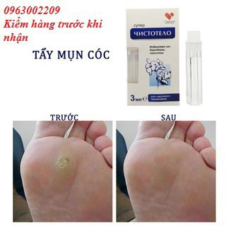 Thuốc chấm Mụn thị, Nốt ruồi, Mụn cóc, Mụn cơm Của Nga