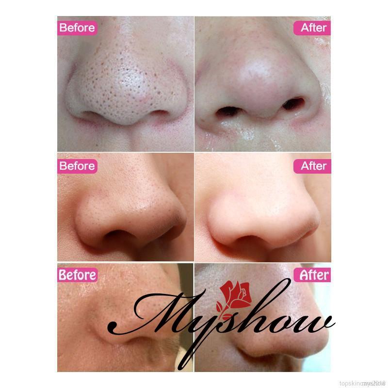 COD Gói 1 miếng dán lột mụn mũi Sace Lady làm sạch da và kiềm dầu | BigBuy360 - bigbuy360.vn