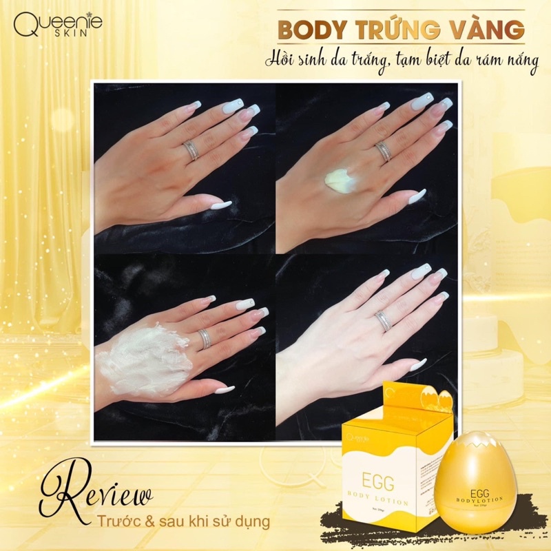 Kem Dưỡng Trắng Da Body Trứng Vàng Queenie [tặng kèm huyết thanh] | BigBuy360 - bigbuy360.vn