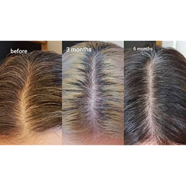 Dầu dưỡng tóc The Ordinary Multi-Peptide Serum For Hair Density | BigBuy360 - bigbuy360.vn