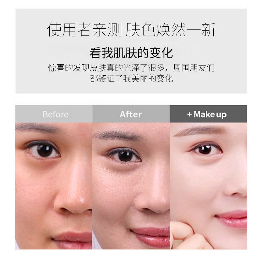 (Hàng Mới Về) Tinh Chất Niacinamide Dưỡng Ẩm Làm Trắng Sáng Da Mặt 30ml