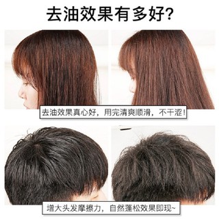 Kiềm dầu cho tóc ( chống bết tóc )