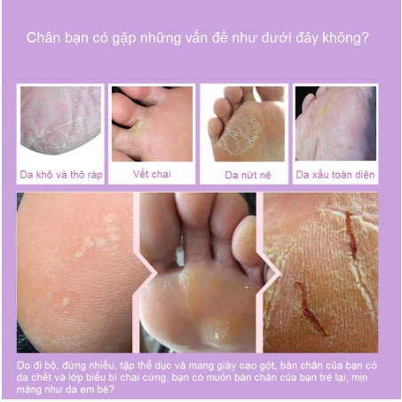 Mặt nạ lavender ủ tẩy tế bào chết bàn chân + tẩy vết chai + nứt gót chân + dưỡng da chânMặt Nạ Ủ Thay Da Chân Foot Peling Mask loại bỏ lớp da thô cứng hỗ trợ làm sáng da cho chân