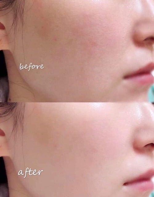 Có xem bill🇺🇸 Tách set chăm sóc da Clinique Skincare TLC kit sáp tẩy trang, vitamin C, kem dưỡng ẩm