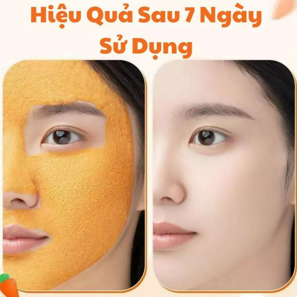 Mặt Nạ Sủi Bọt Cà Rốt Thải Độc YINBA Trắng Da, Mặt Nạ Cà Rốt Hộp 12 Gói Sạch Bụi Bẩn, Dầu Thừa, Giảm Mụn Đầu Đen