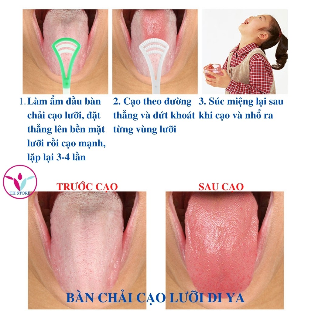 Dụng cụ vệ sinh lưỡi Di ya