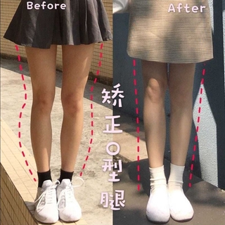 Miếng Lót Giày Chỉnh Hình Chân Chữ O
