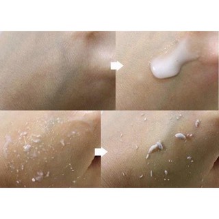 Gel Tẩy Tế Bào Chết PEELING GEL 3W CLINIC