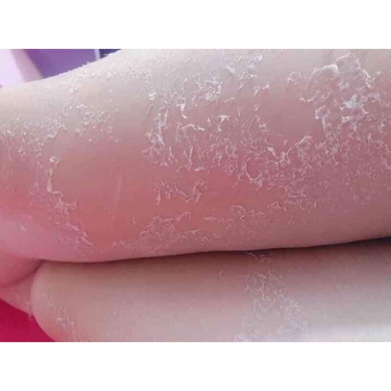 Kem tái tạo da body  - Bịch 1kg