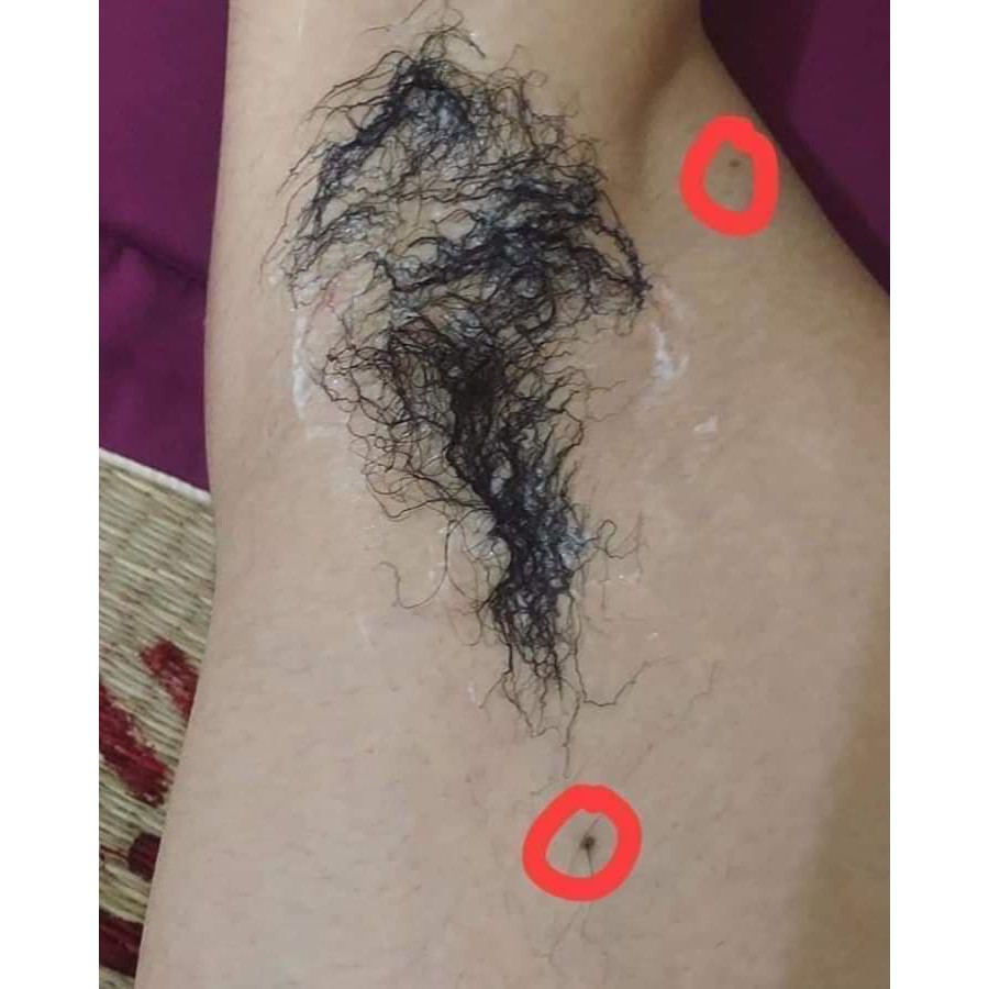 (Mua 1 tặng 1 serum)Kem Tẩy Râu Lông Vĩnh viễn Trắng Da Không Mọc Lại | BigBuy360 - bigbuy360.vn